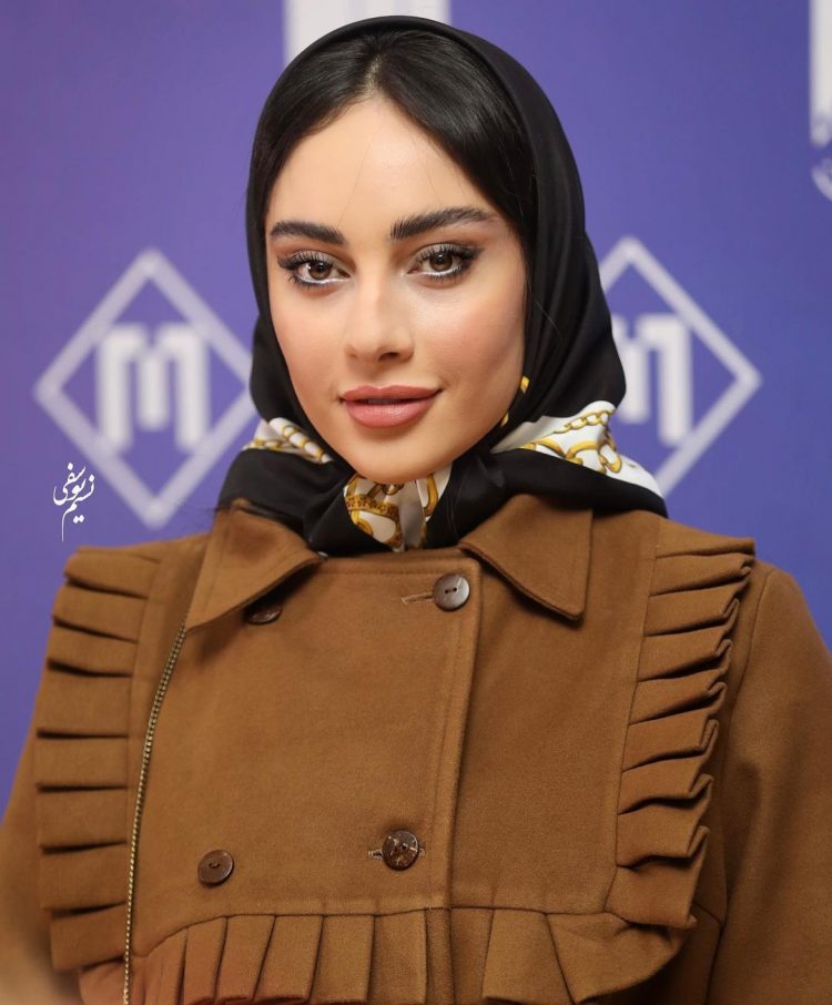 غافلگیری با تغییر چهره عجیب ترلان پروانه!/عکس