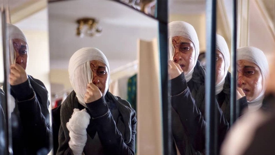 صورت زیبای خانم بازیگر نابود شد/عکس