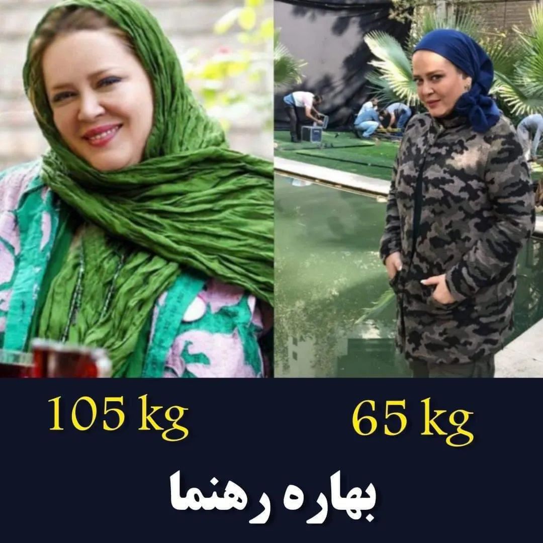 عکس قبل و بعد لاغری بهاره رهنما عکس قبل و بعد لاغری بهاره رهنما