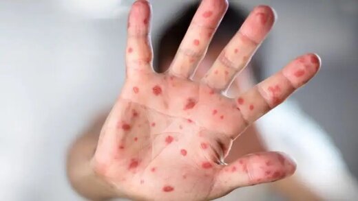 ویروس جدید چیست و چقدر ترسناک است؟ آنفلوانزای گوجه فرنگی ! ویروس جدید چیست و چقدر ترسناک است؟ آنفلوانزای گوجه فرنگی !