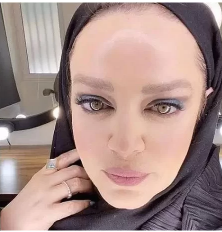 بهاره رهنما با عمل های زیبایی دختر 20 ساله شد/ عکس