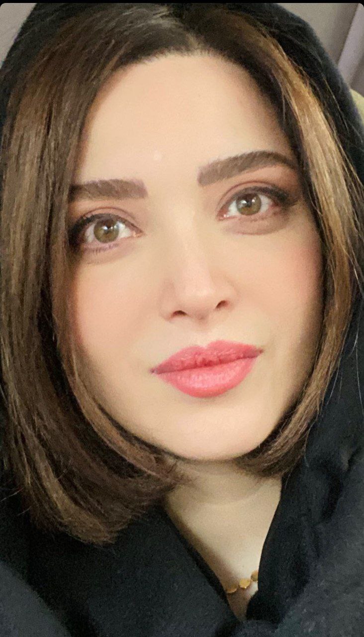 تغییر مجدد چهره بهنوش طباطبایی/ عکس