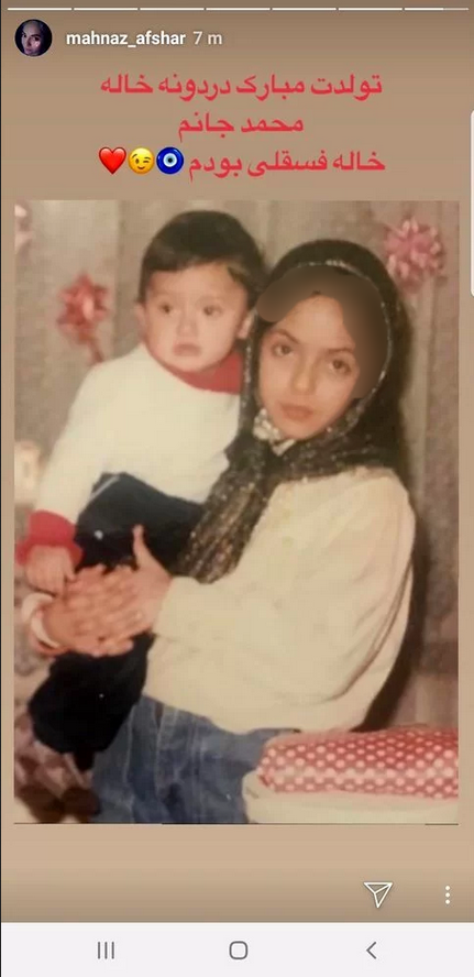 مهناز افشار قبل از عمل زیبایی چه شکلی بود/عکس