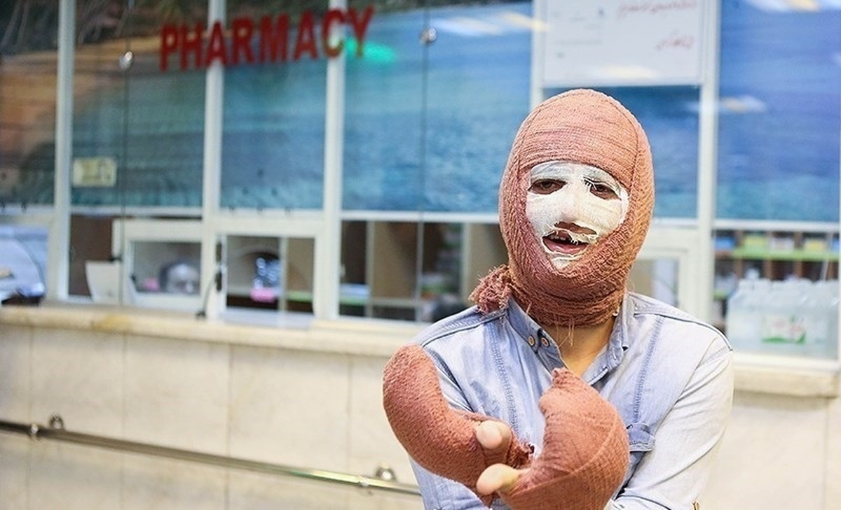 مصدومیت شدید جوان ۲۱ ساله با انفجار ترقه دستساز مصدومیت شدید جوان ۲۱ ساله با انفجار ترقه دستساز