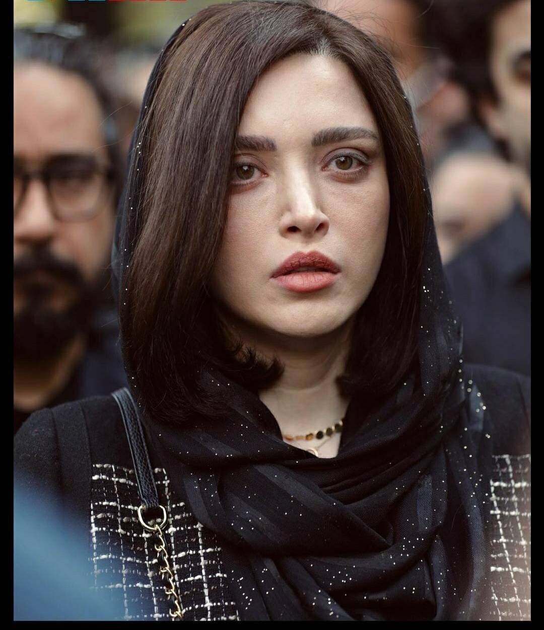 لو رفتن راز های عمل زیبایی بهنوش طباطبایی/عکس