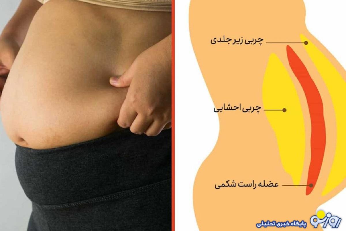 چربی شکم چیست و راههای درمان آن کدامند؟ چربی شکم چیست و راههای درمان آن کدامند؟