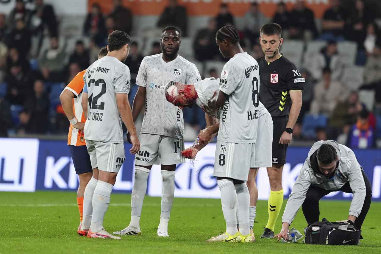 مصدومیت شدید سردار دورسون از ناحیه سر در ترکیه؛ مهاجم سابق پرسپولیس غرق در خون / عکس مصدومیت شدید سردار دورسون از ناحیه سر در ترکیه؛ مهاجم سابق پرسپولیس غرق در خون / عکس