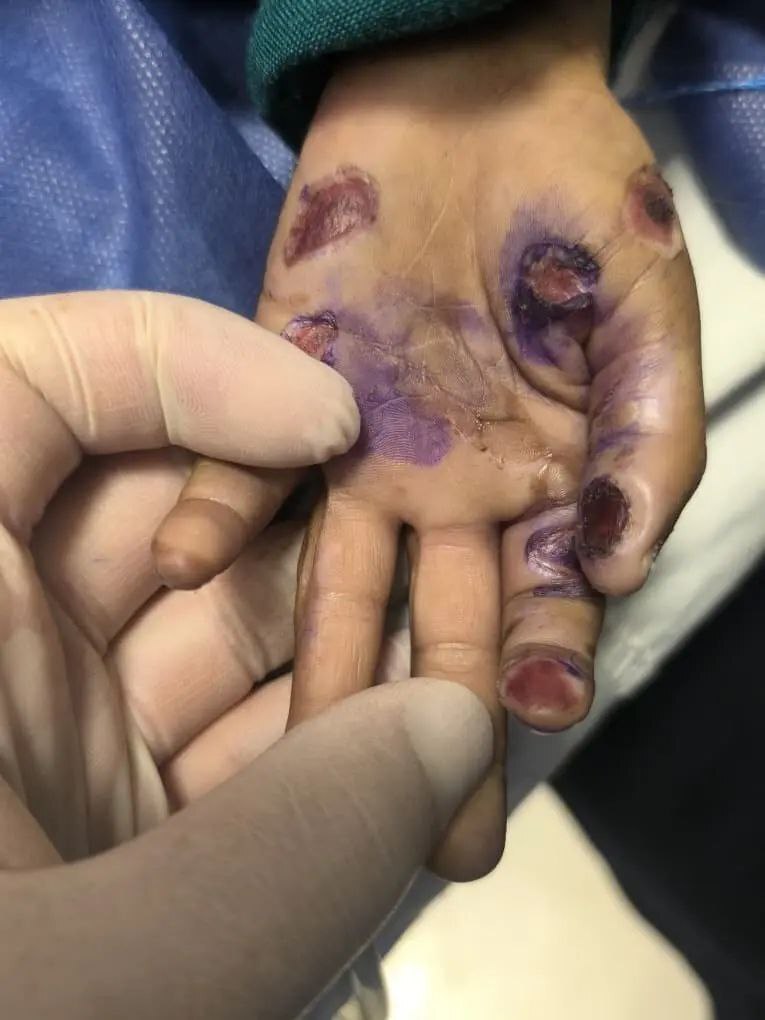 فوت یک کودک ۴ساله فوت یک کودک ۴ساله