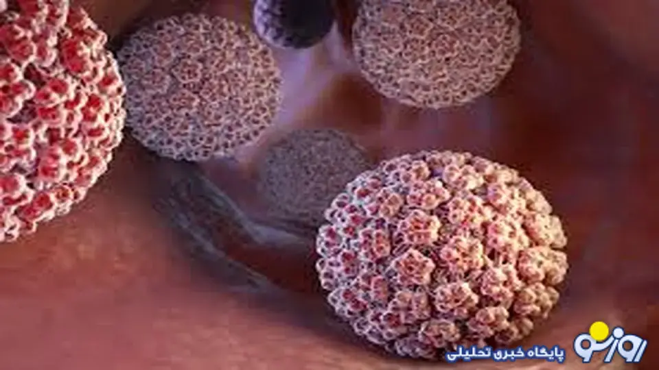 زگیل تناسلی در بچه مدرسهایها! زگیل تناسلی در بچه مدرسهایها!