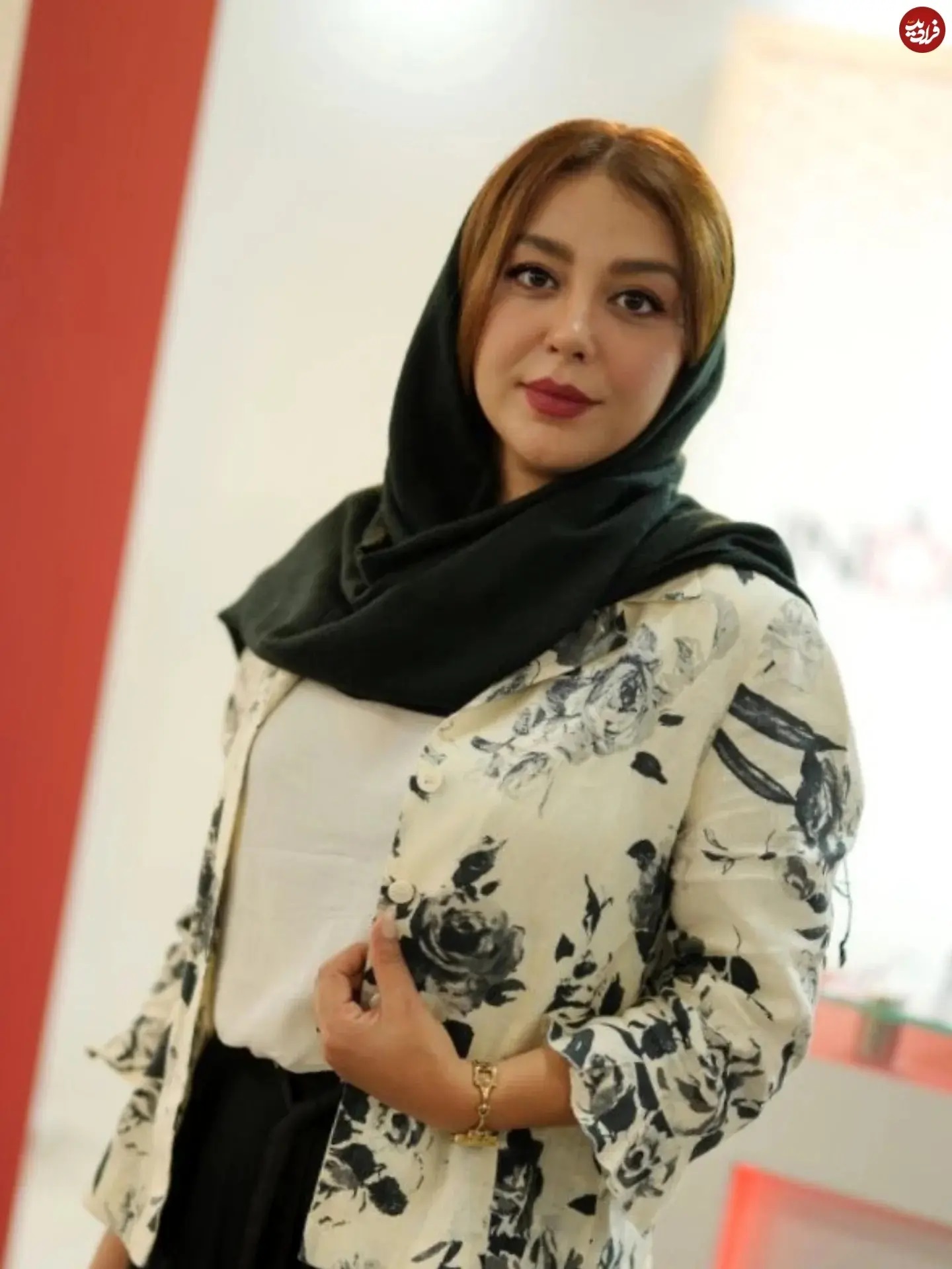 تغییر چهره شوکه کننده مونا غمخوار تغییر چهره شوکه کننده مونا غمخوار